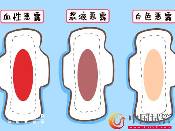 盤點產后惡露會有幾種顏色，出現黑色就需注意了！(圖1)