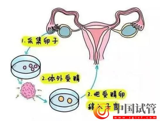 新一代試管嬰兒技術發布！專家：每年可多生10萬以上嬰兒(圖3)