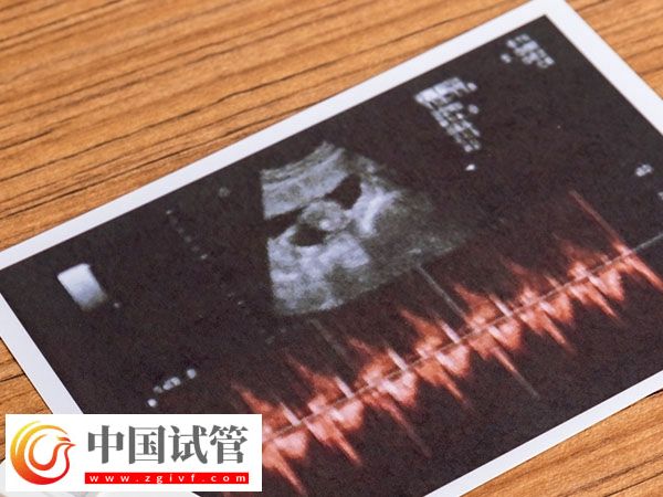 杭州正規促排醫院排名公布，浙江省婦保醫院綜合第一(圖1)