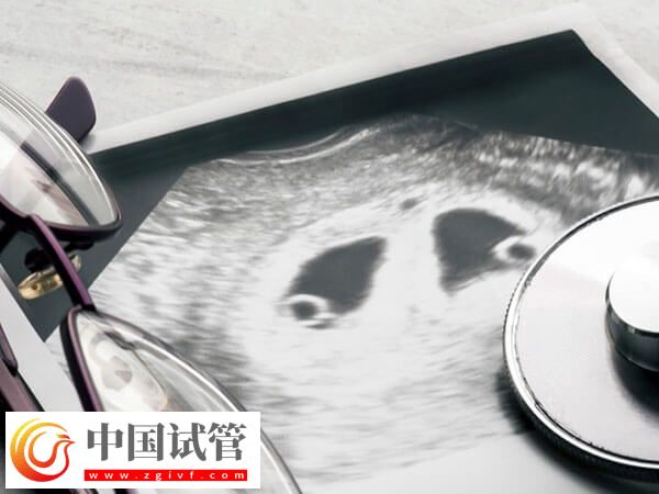 殘角子宮助孕選成都哪家醫(yī)院好？對比成功率選更放心(圖2)