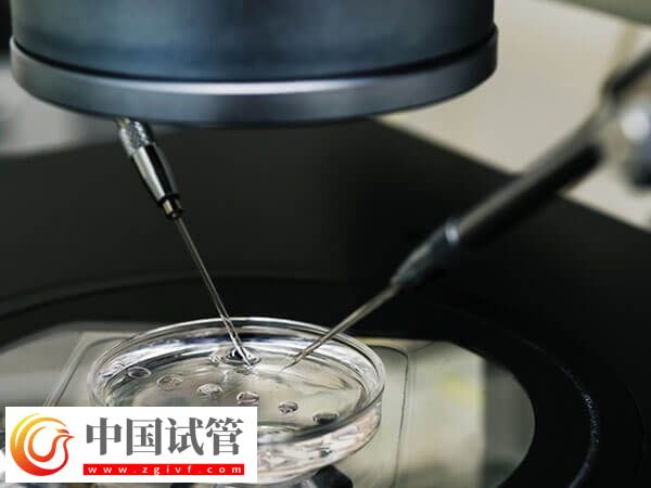 綿陽市中心醫(yī)院助孕全程開銷匯總，檢查到手術(shù)至少3w(圖1)