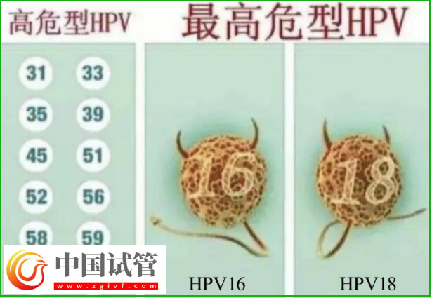 通過(guò)hpv報(bào)告單圖片怎么判斷自己是正常的呢？(圖3)
