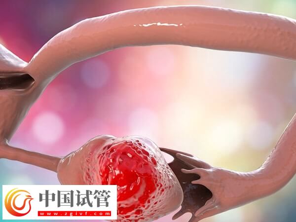 試管嬰兒也有弊端，提前了解各階段注意事項可減少風險(圖2)