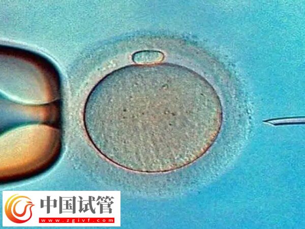 廣州市第一人民醫(yī)院試管嬰兒價格，養(yǎng)囊4千起(圖1)