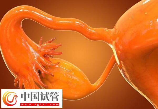 先天性卵巢發育不全可不可以做試管嬰兒(圖1)