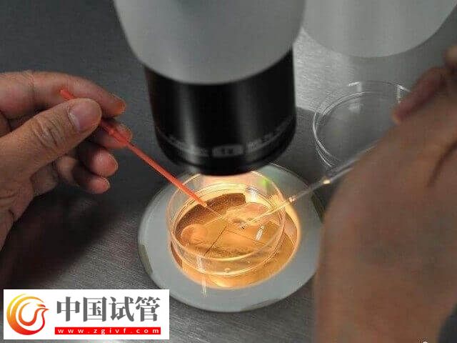 胚胎培養液對試管嬰兒有沒有影響(圖1)