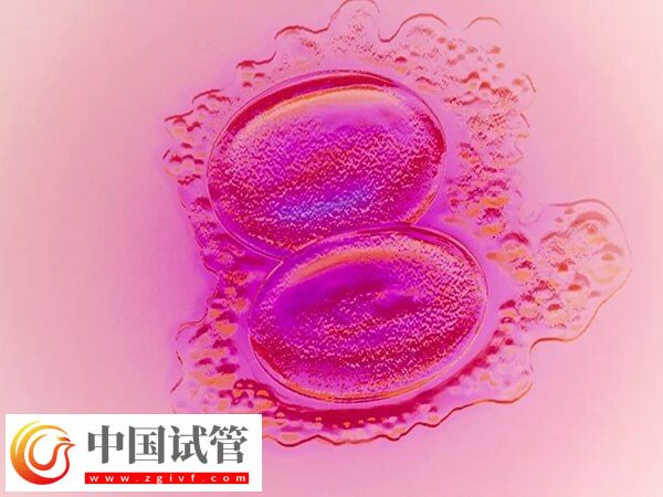 只移植一個胚胎怎么還會懷上雙胞胎(圖1)