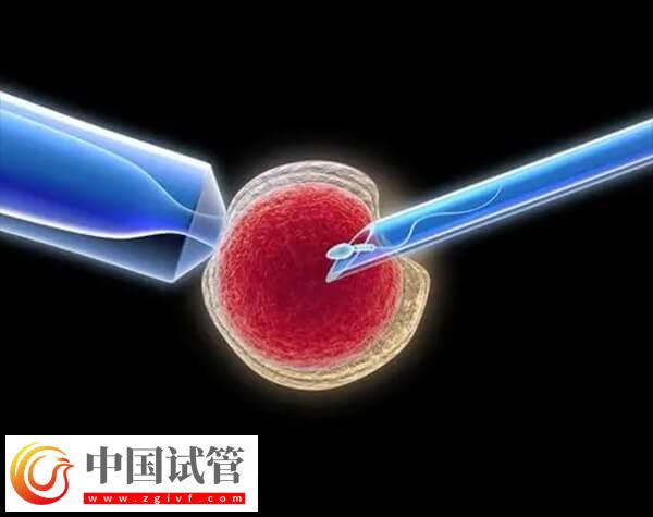 做試管嬰兒出現(xiàn)腹水的原因是什么(圖1)