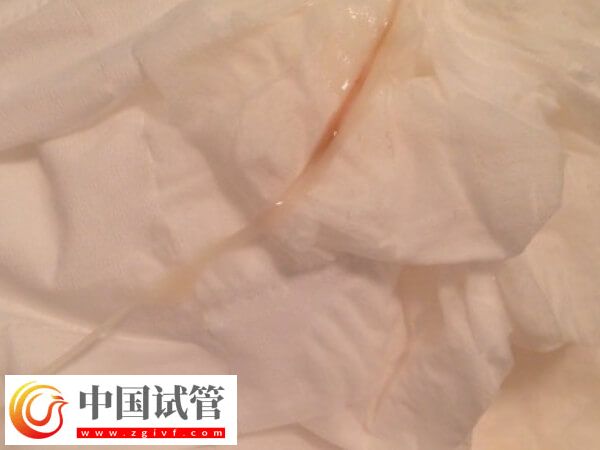 試管嬰兒囊胚移植10天只有淺粉有機會，時間不一也正常(圖1)