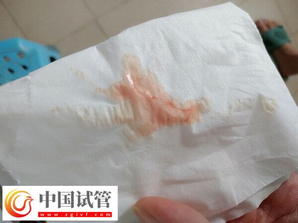 試管嬰兒取卵后月經(jīng)不調(diào)怎么回事(圖1)