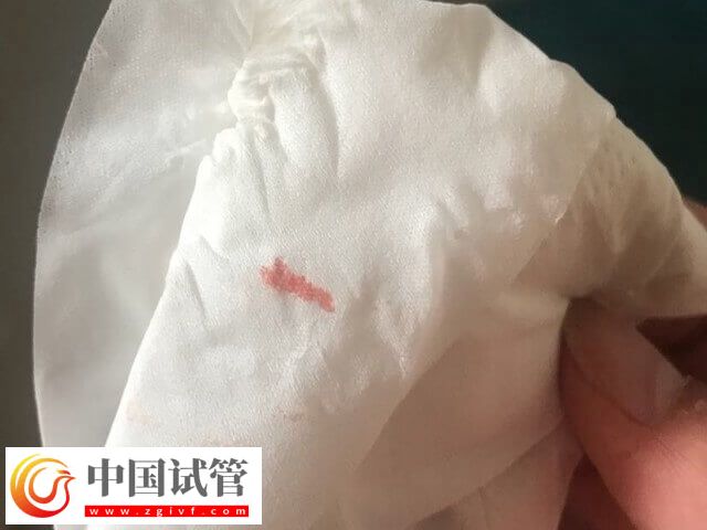 試管移植后著床有什么反應(圖1)