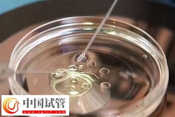 10個人做試管幾個能成功(圖1)