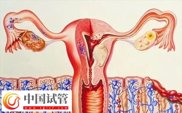 子宮內膜厚度多少做試管嬰兒才能成功著床？(圖3)