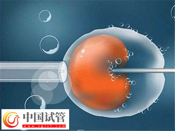 日照人民醫(yī)院試管條件(圖3)