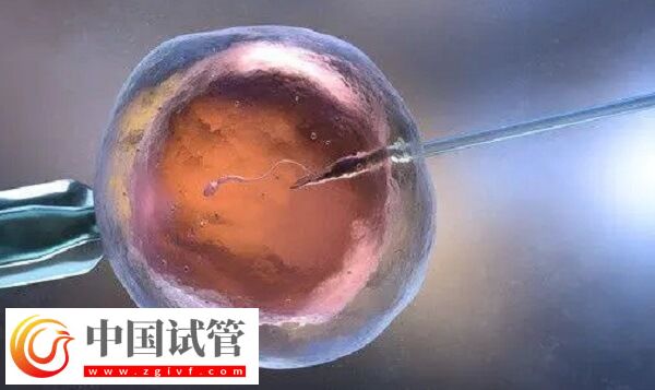 雌激素高做試管前怎么辦(圖1)