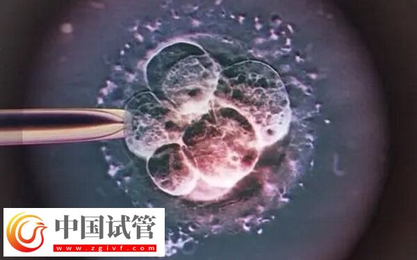 移植一個(gè)凍胚8c2成功率高不高(圖1) 移植一個(gè)凍胚8c2成功率高不高(圖1)