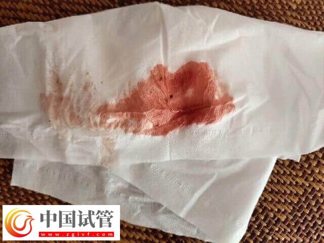 試管移植后不規(guī)則出血怎么辦(圖1)