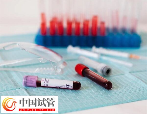 試管移植9天血值范圍是多少(圖1) 試管移植9天血值范圍是多少(圖1)