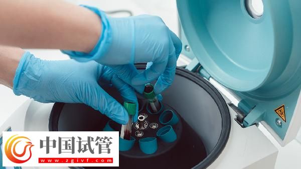 血常規(guī)五項(xiàng)是哪五項(xiàng)(圖3)