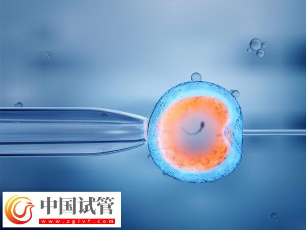 50歲試管嬰兒的條件有哪些(圖1) 50歲試管嬰兒的條件有哪些(圖1)