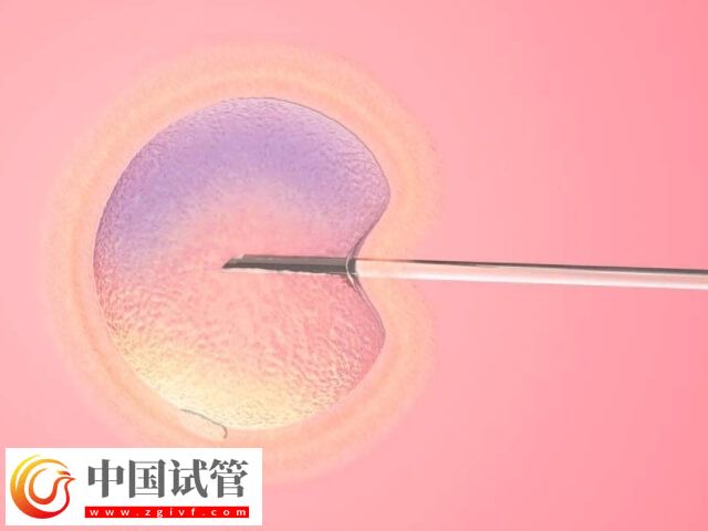 為什么子宮大不能移植胚胎(圖1)