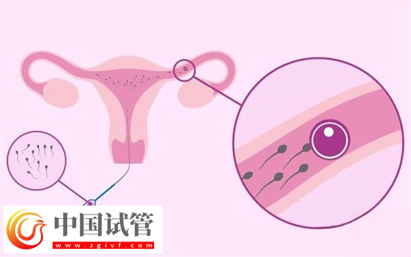 在武漢協(xié)和醫(yī)院申請(qǐng)供精能做幾次(圖3)