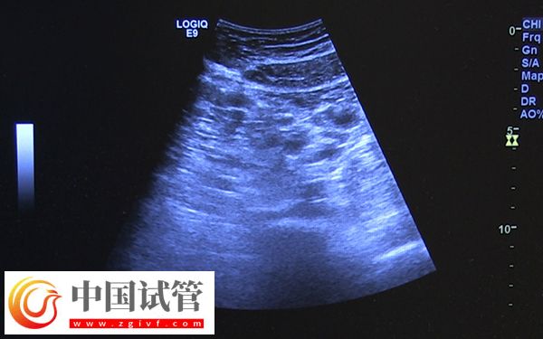 咸寧市中心醫院監測卵泡多少錢(圖1)