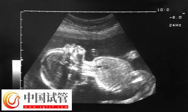 助孕4月后出血原因(圖4)