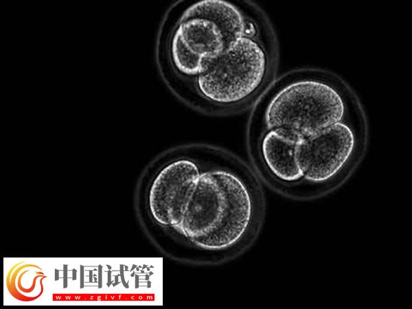 4個胚胎做試管夠不夠(圖2)