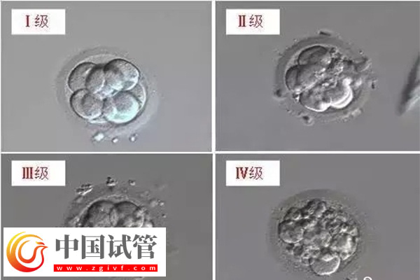 4個胚胎做試管夠不夠(圖1)