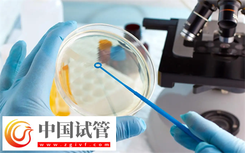 多囊患者試管選擇什么方案好？(圖1)