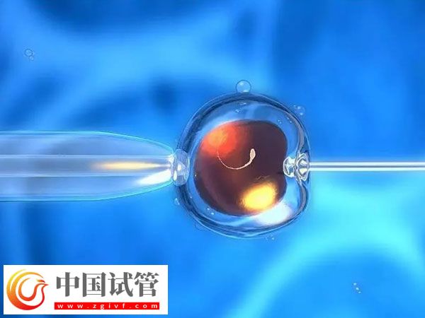 杭州省婦保醫院和市一醫院做試管哪個好(圖2)