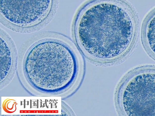 促排6個基礎(chǔ)卵泡能取多少個卵(圖1)