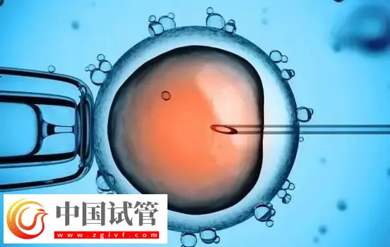 深圳生殖中心最好的醫(yī)院：深圳市人民醫(yī)院排在榜首(圖3)