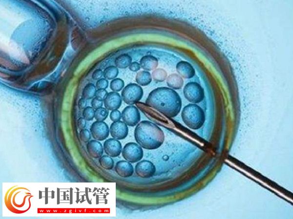 前往長(zhǎng)沙做三代試管生孩子多少錢(圖1)