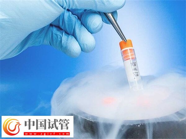試管凍精費用是多少(圖1)