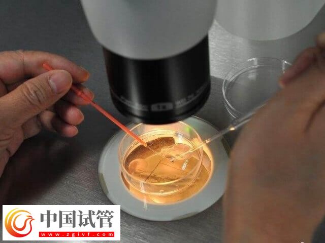 胚胎著床失敗是什么情況(圖1) 胚胎著床失敗是什么情況(圖1)