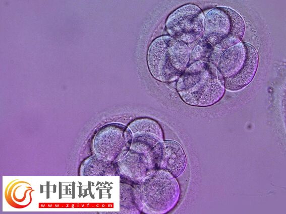試管嬰兒什么情況下養(yǎng)囊(圖1) 試管嬰兒什么情況下養(yǎng)囊(圖1)