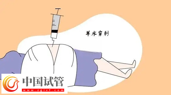 申請供精試管懷孕必須要查羊穿(圖1) 申請供精試管懷孕必須要查羊穿(圖1)