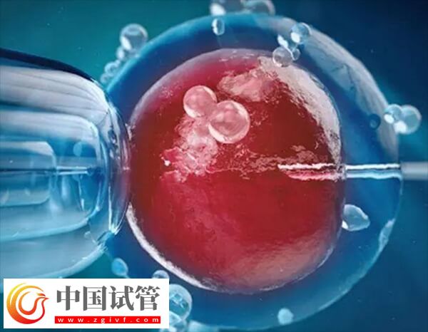 試管嬰兒能否一次移植成功(圖2)