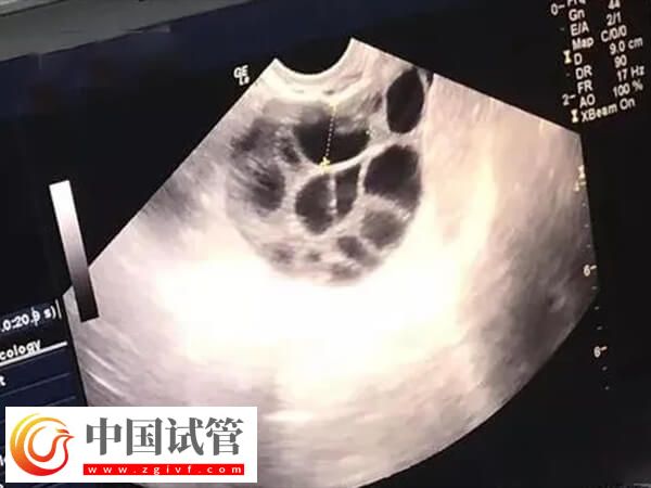 取卵18個能配多少胚胎(圖2)