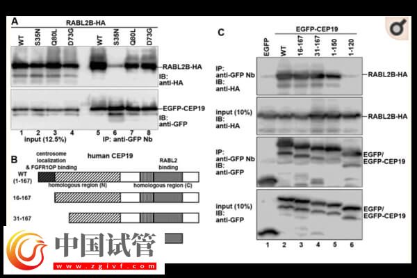 CEP19基因缺陷應該怎么處理(圖1)