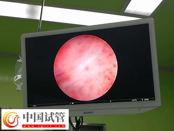 凍胚移植失敗了是不是質量不好(圖2)