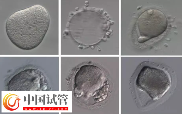 女性內(nèi)膜13b是否可以移植囊胚胚胎(圖3)