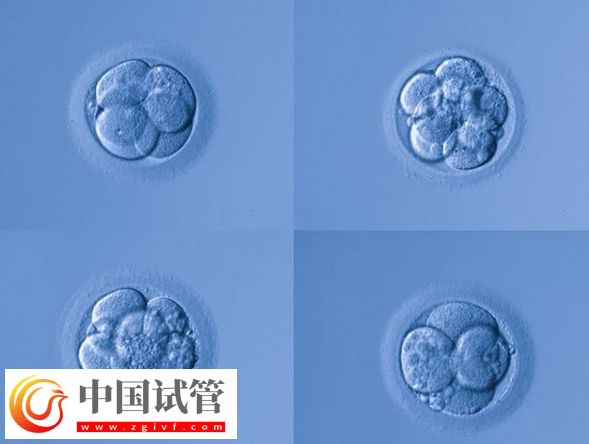 試管嬰兒fet移植成功率是多少(圖1)