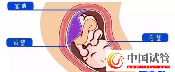 1分鐘了解胎盤前壁和后壁的3大區別,為孕期做好準備(圖2) 1分鐘了解胎盤前壁和后壁的3大區別,為孕期做好準備(圖2)