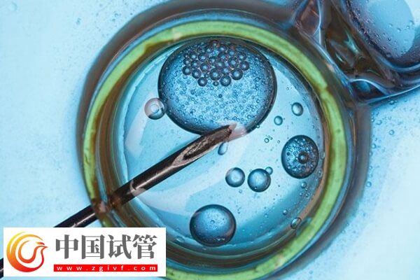 做試管對(duì)amh值有沒有要求(圖1) 做試管對(duì)amh值有沒有要求(圖1)