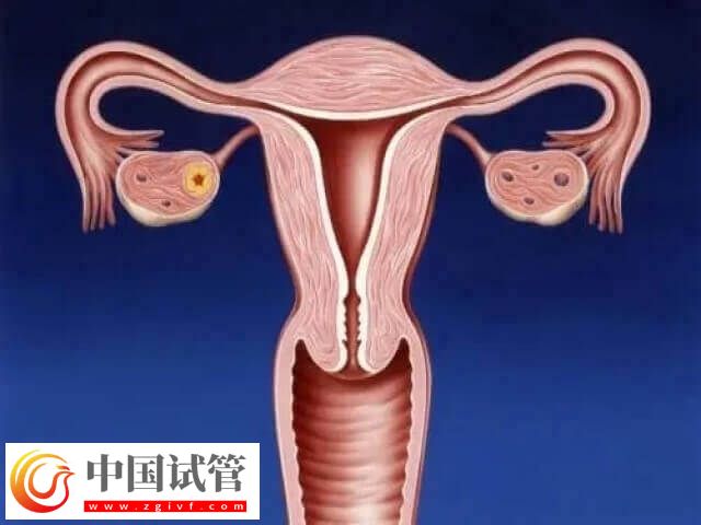 amh低做試管成功可能性大不大(圖1)