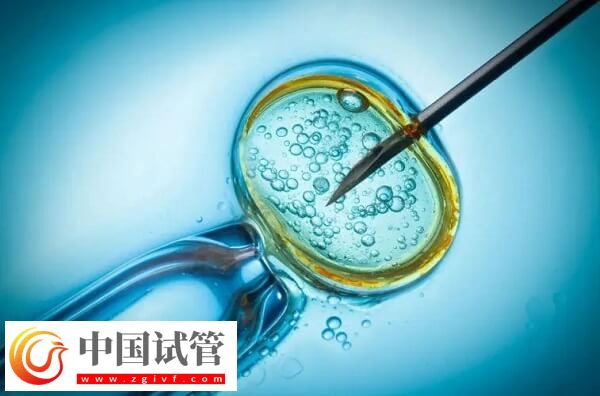 試管嬰兒是不是容易引發(fā)早產(chǎn)(圖2) 試管嬰兒是不是容易引發(fā)早產(chǎn)(圖2)