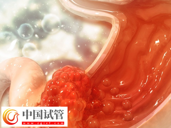 做試管吃芬必得的作用和功效(圖2)